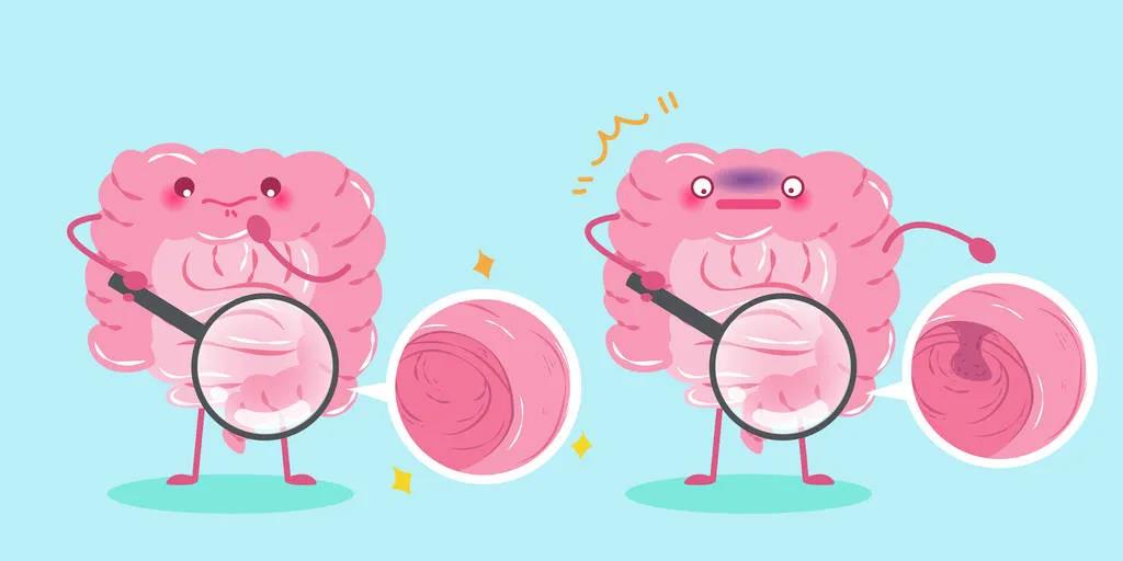 因?yàn)楹鲆暽眢w出現(xiàn)的這些變化，他們最后被確診結(jié)腸癌