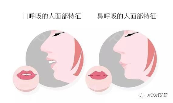 過敏性鼻炎會(huì)讓孩子變傻？！家長(zhǎng)該如何應(yīng)對(duì)